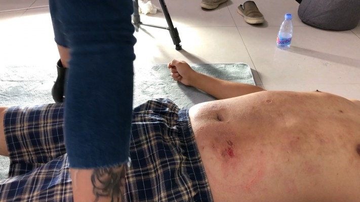 【蓝色-凌然】两个血洞!!! YC-210822-4